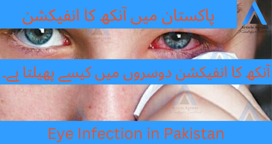 Eye Infections in Pakistan